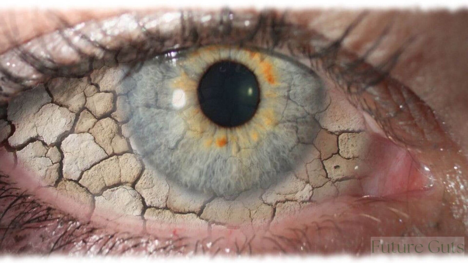 How to Cure Dry Eyes Permanently